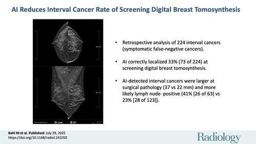 Trí tuệ nhân tạo trong giảm tỷ lệ ung thư khoảng trống (interval cancer) khi sàng lọc bằng nhũ ảnh cắt lớp (Digital Breast Tomosynthesis – DBT)